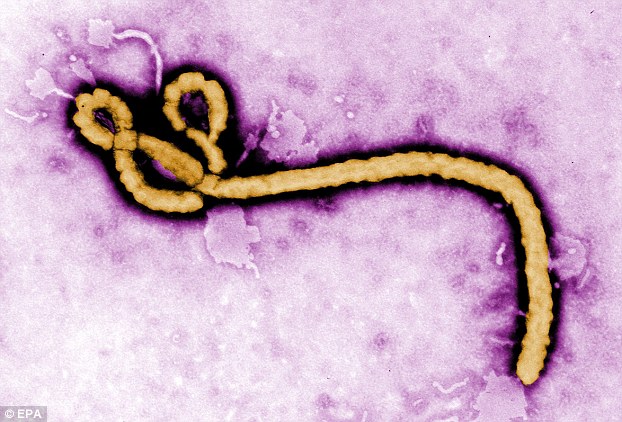 140730-ebola-virus