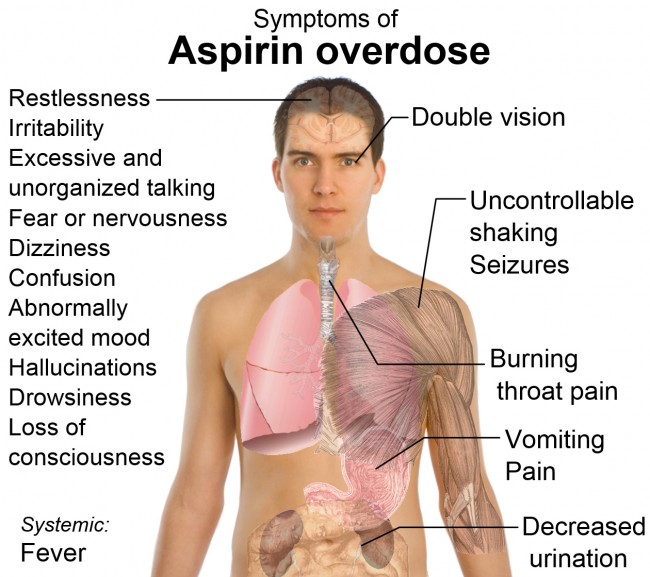 aspirin-overdose-01