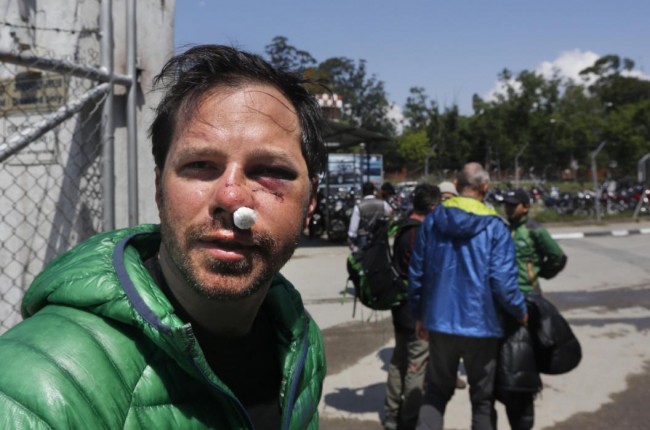 U.S. citizen Michael Churton, 38, from New York, who was injured during an avalanche resulting from Saturdays earthquake at the base camp of the mount Everest, arrives at the domestic airport in Kathmandu, Nepal, Monday, April 27, 2015. Saturday's magnitude 7.8 earthquake spread horror from Kathmandu to small villages and to the slopes of Mount Everest, triggering an avalanche that buried part of the base camp packed with foreign climbers preparing to make their summit attempts. (AP Photo / Manish Swarup)