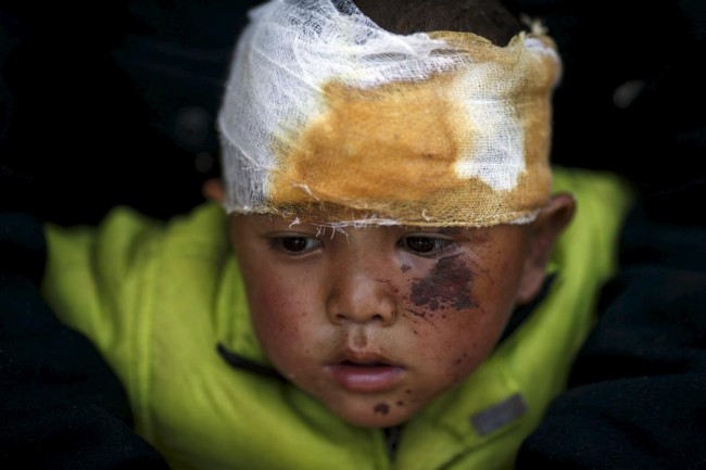 Abhishek Tamang, 4, looks on after receiving medical treatment, following Saturday's earthquake, at Dhading hospital, in Dhading Besi, Nepal April 27, 2015.  REUTERS/Athit Perawongmetha